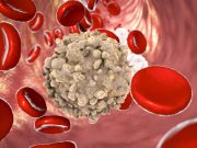 In Italia arriva un nuovo farmaco contro la leucemia