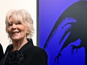 Caterina Caselli cade e si frattura l’omero